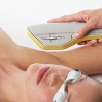 Depilación Exilite: tecnología avanzada para una piel suave y sin vello