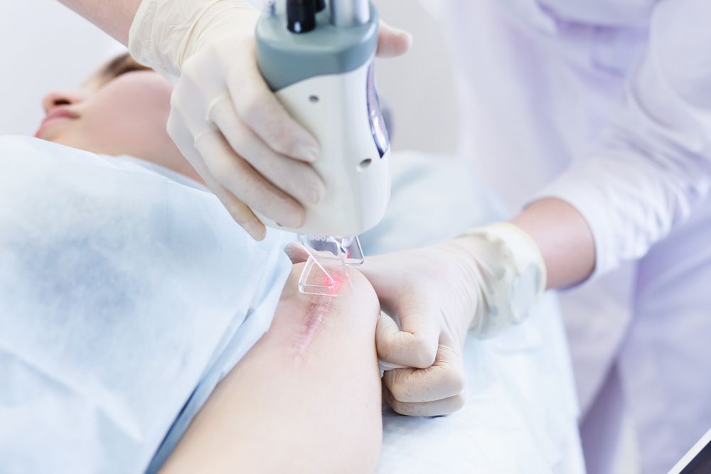 uso-del-laser-para-el-tratamiento-de-cic
