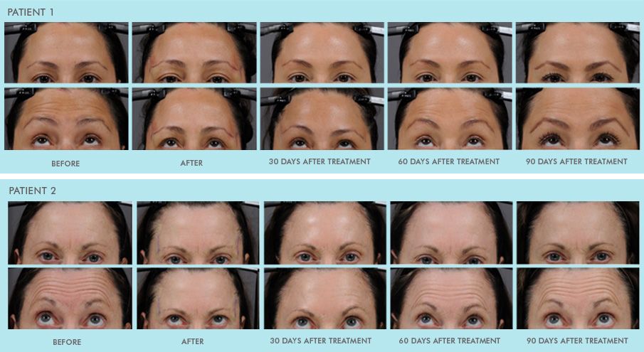 before-after-pics.jpg