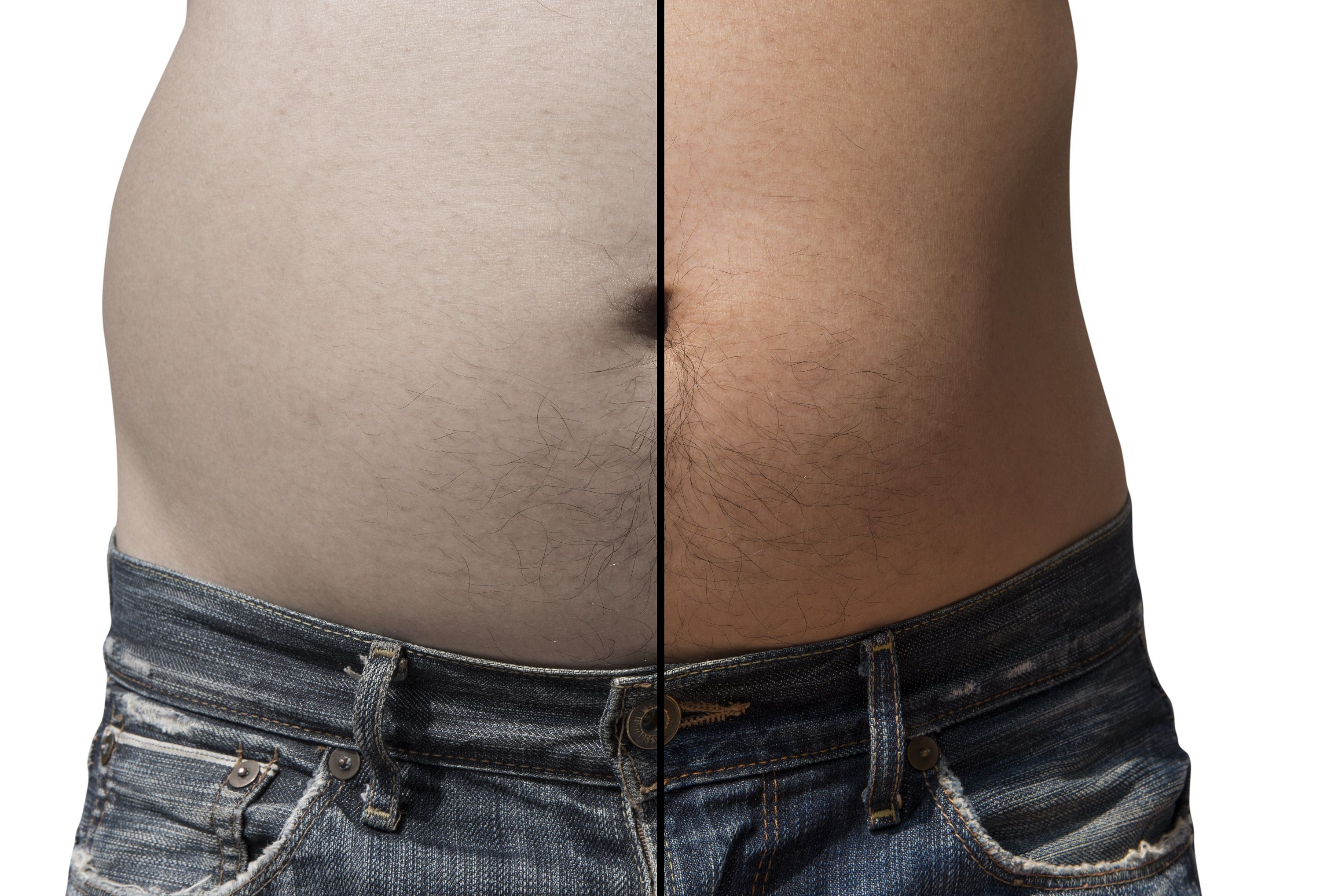 lipo2.jpg