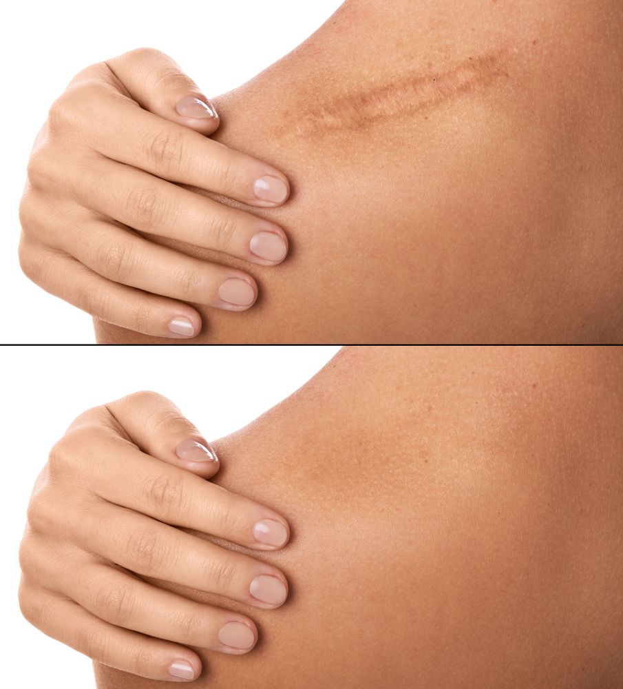 Antes y despues