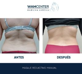 Masaje reductivo - WamCenter