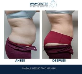 Masaje reductivo - WamCenter