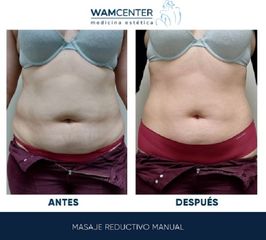Masaje reductivo - WamCenter