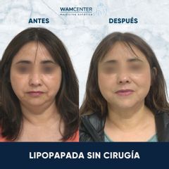 Lipopapada - WamCenter