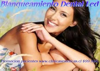 Promocion Blanqueamiento Dental