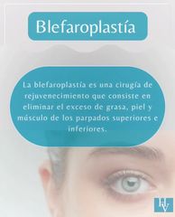 Blefaroplastia, Doctor Horacio Valdivia Meza