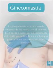 Ginecomastia, Doctor Horacio Valdivia Meza