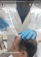 Alopecia - Dr. Miguel Enrique Sánchez Hechavarria