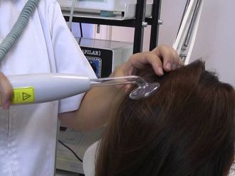 Alopecia - 617897