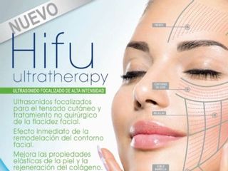Hifu Ultherapy 