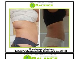 Tratamiento reafirmante y modelador 