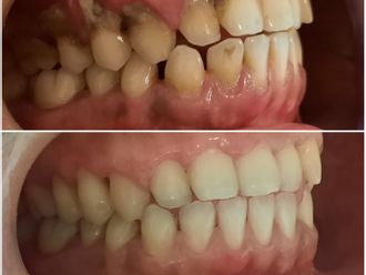 Limpieza dental - 794999