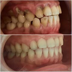 Limpieza dental - Dra. Rocío Rocha