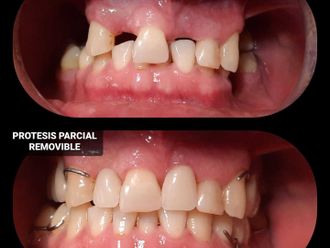 Prótesis dentales - 814284