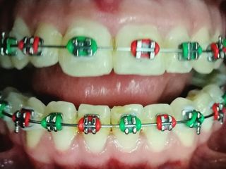 Brackets