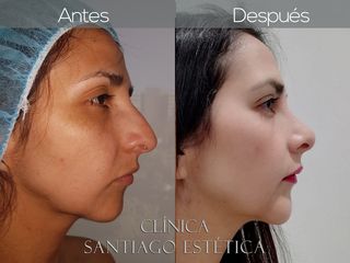 Clínica Santiago Estética 