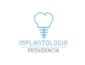 Implantología Providencia