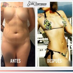 MELA - Dr. Freddy Carrasco