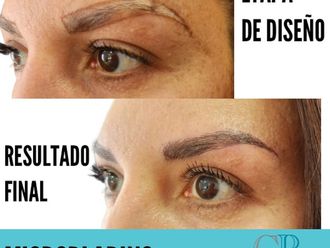 Microblading antes y después - 866526