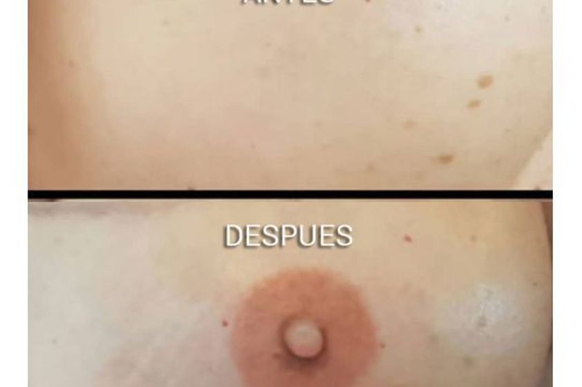 Micropigmentación antes y después - 650971