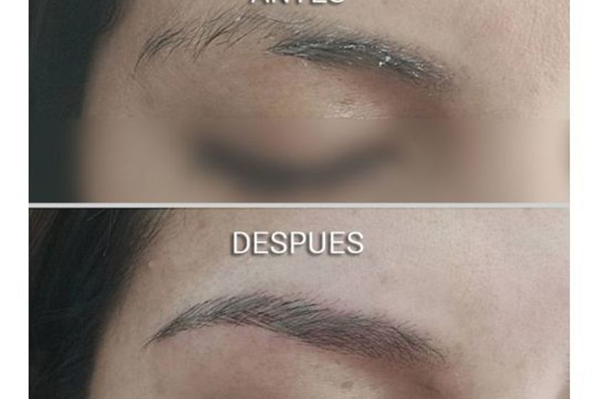 Micropigmentación antes y después - 650972