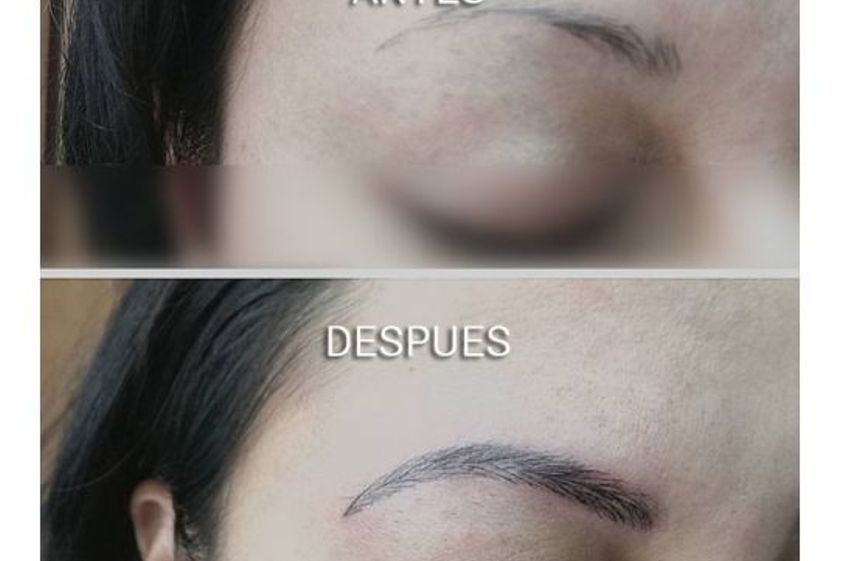 Micropigmentación antes y después - 651001