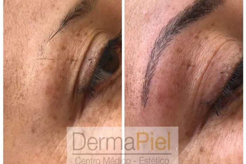 Microblading antes y después - 627376