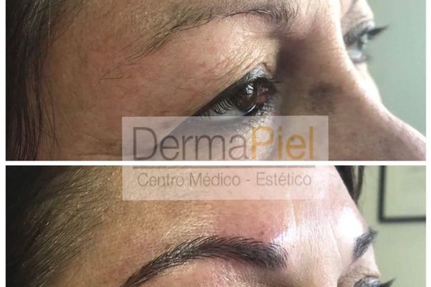 Microblading antes y después - 628142
