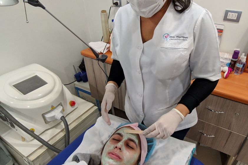 Peeling antes y después - 639669