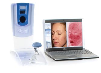 Escaner Facial Reveal