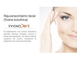 Rejuvenecimiento facial - Toxina botulínica