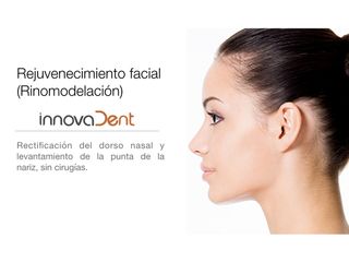 Rejuvenecimiento facial - Rinomodelación