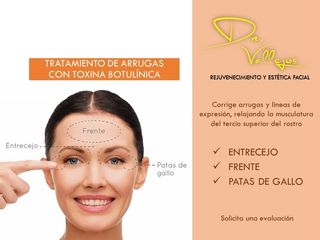 Tratamiento para arrugas y líneas de expresión con Botox® 