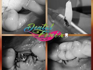  Clínca DentalFenix 