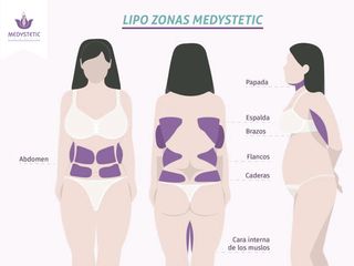 Lipo sectorial a tu alcance