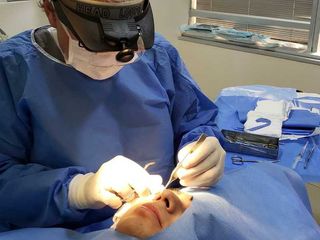 BLEFAROPLASTIA SUPERIOR