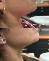 Lipopapada - Dra Ivanna Nikovic