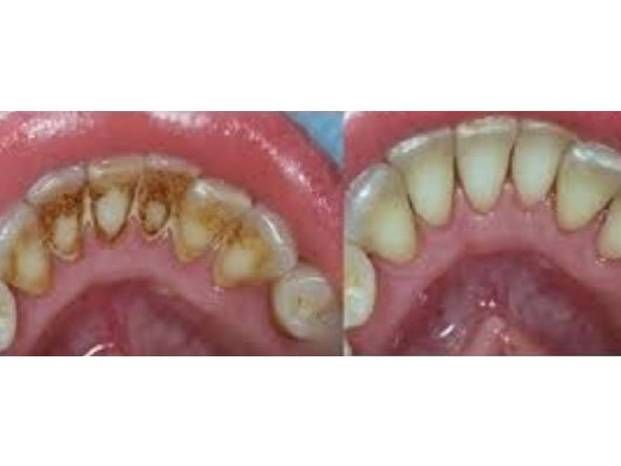 Clinica Dental Galapagos Clinicasesteticascl 3892
