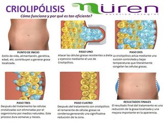 Como funciona la Criolipólisis 