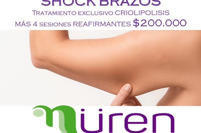 Criolipólisis antes y después - 618698