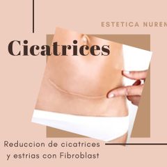 Atenúa y elimina cicatrices 