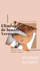 Elimina verrugas lunares y manchas de la edad de forma rápida y segura 