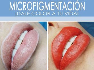 Micropigmentación - 637166