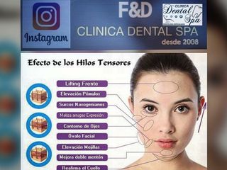 EFECTO DE HILOS TENSORES 