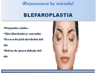 Blefaroplastia