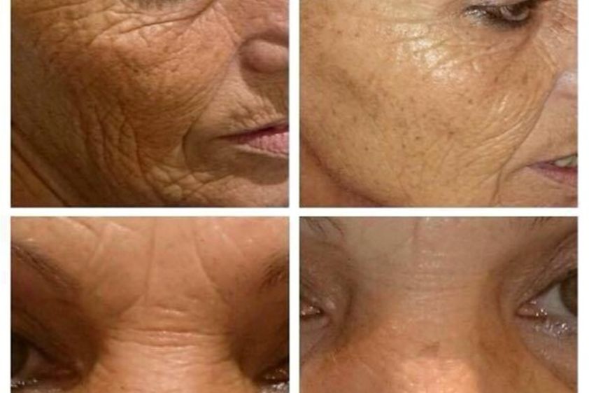 Células madres antes y después - 590708