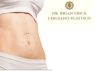Liposucción Dr. Brian Frick 