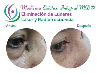 Lunares - 632600