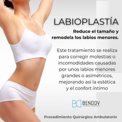 Labioplastía - Clinica Bendov